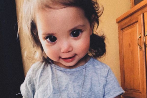 Toddler's huge eyes are the result of a rare genetic condition (Karina Martinez)