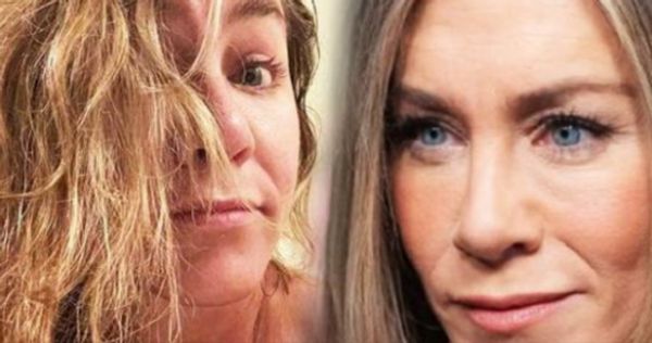 Jennifer Aniston opens up about her plastic surgery, says she’ll never inject “s**t into my face”