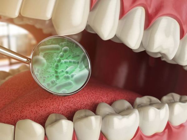 The cure that removes all bacteria from your mouth in just 5 minutes