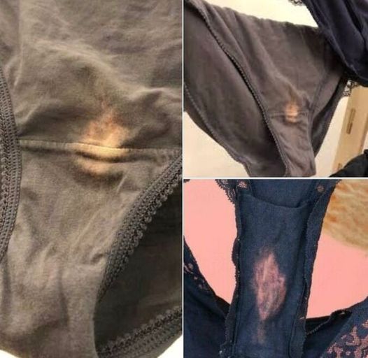 If You Find a “Bleach” Patch on Your Underwear, Here’s What It Means