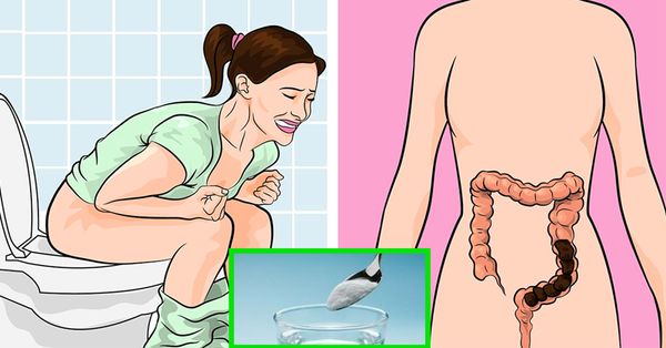 Natural Remedies to Relieve Constipation