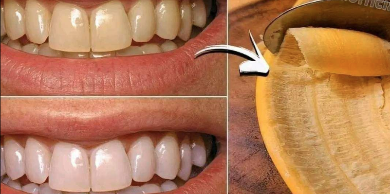 Secret That Dentists Don’t Want You to Know